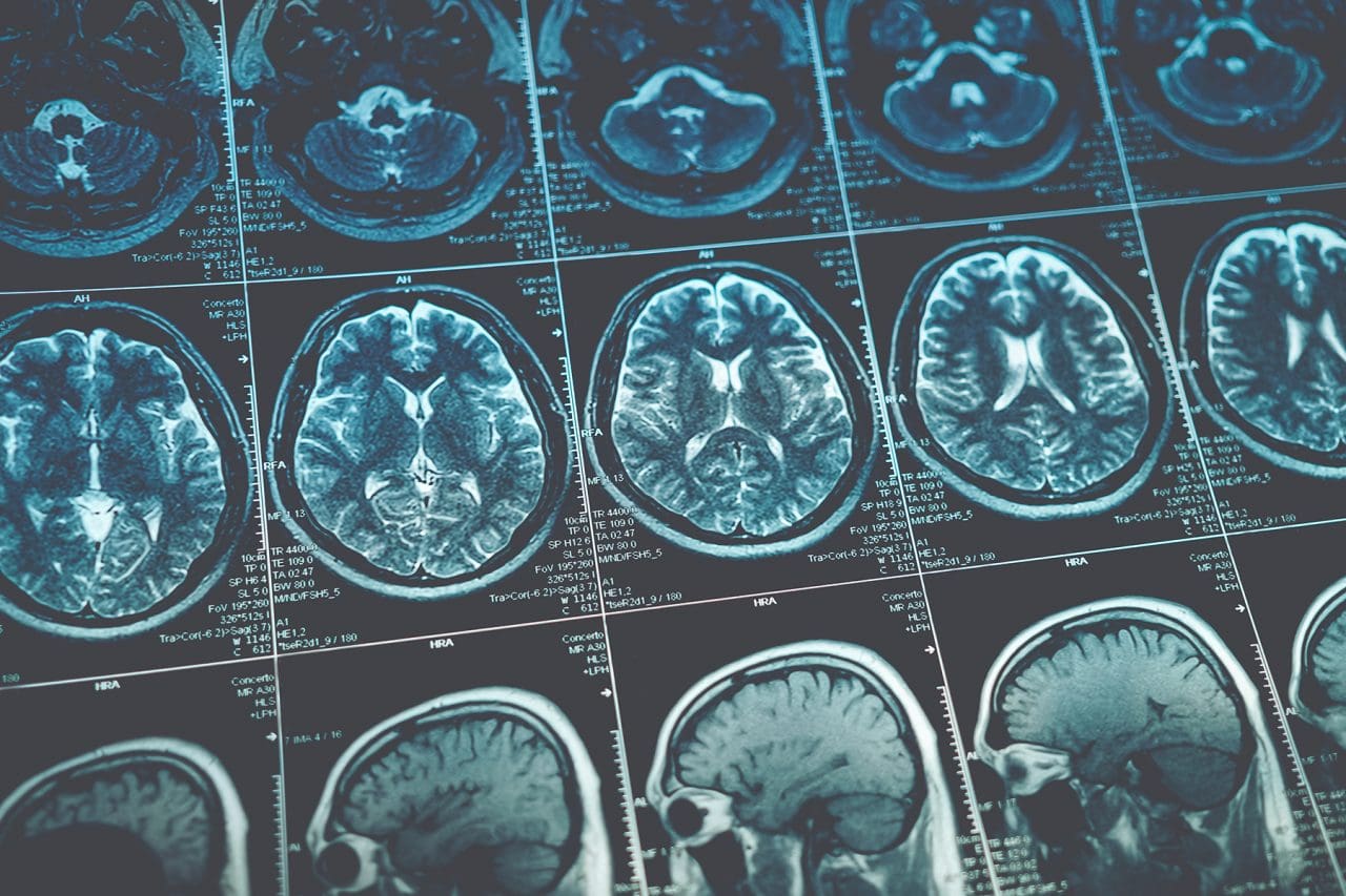 ELab LIMS for Neuropathology Optimizes Lab Operations | LabLynx