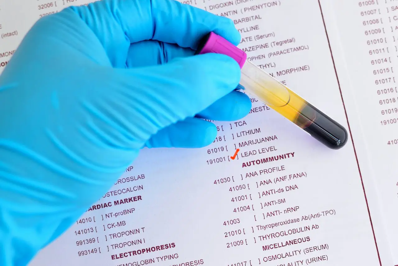 Improve Your Lab’s Productivity with ELab LIMS for Toxicology | LabLynx