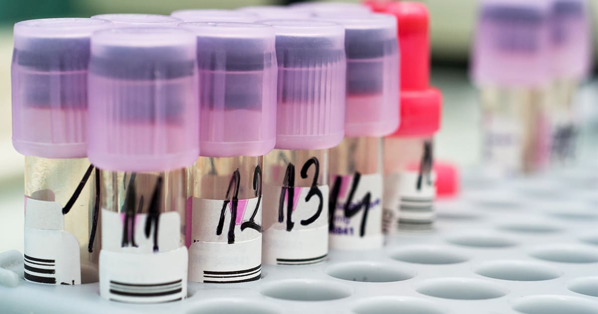 Lost Samples? The Label Blunder That’s Costing Labs Millions (Fix It With This Simple Inventory Trick!) | LabLynx LIMS