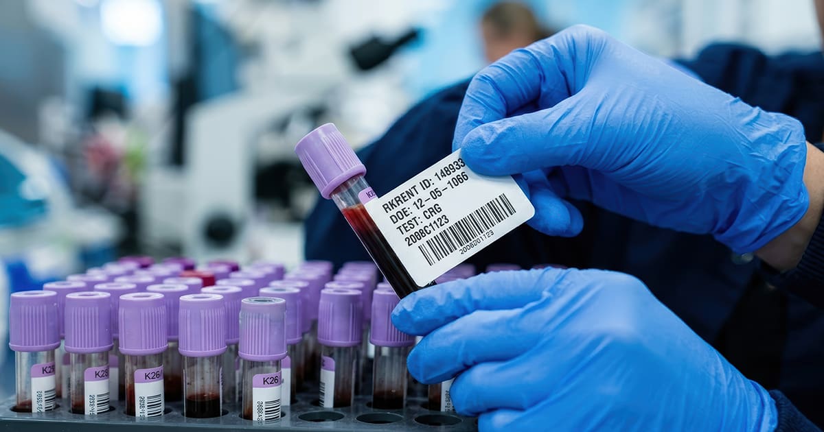 Lab technician in blue gloves labeling a blood sample beside a rack of purple-capped vials.